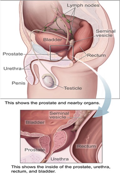 Hasznos termékek a prosztatitis kezelésében A prosztatitis befolyásolhatja a tesztoszteront