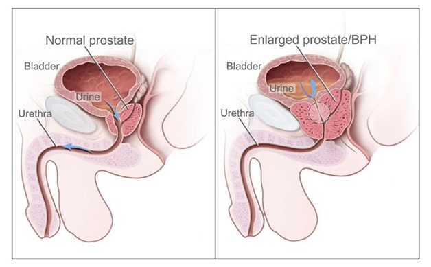 normal size of prostate gland in centimeters