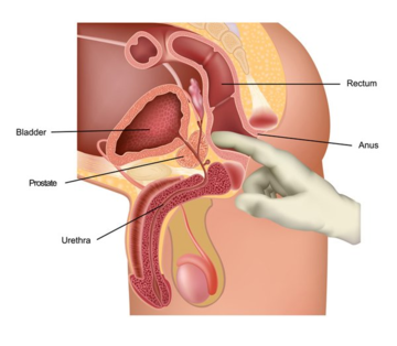 Prostate Massage Therapy