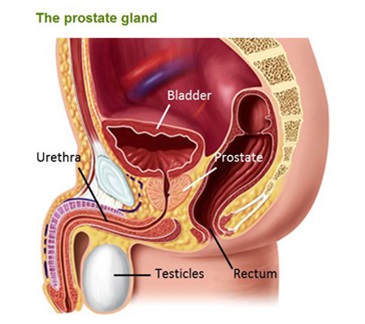 disconfort prostatita